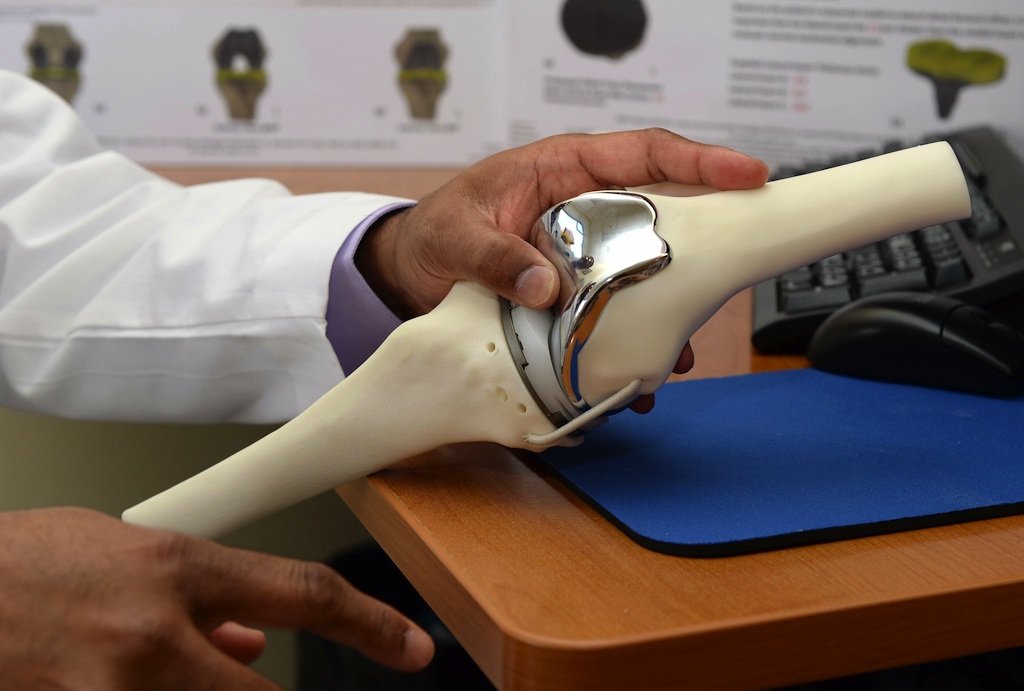 Joint Replacement