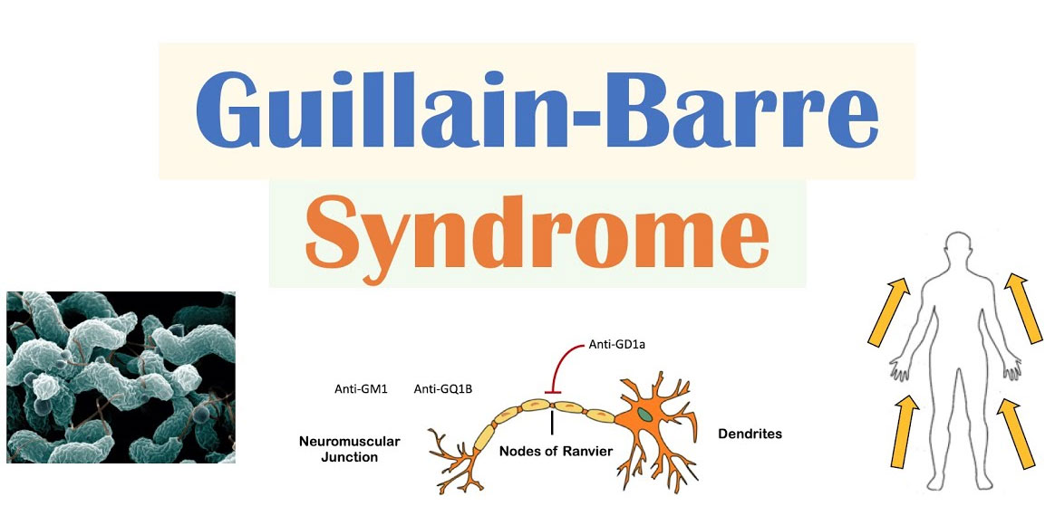 Guillain Barre Syndrome